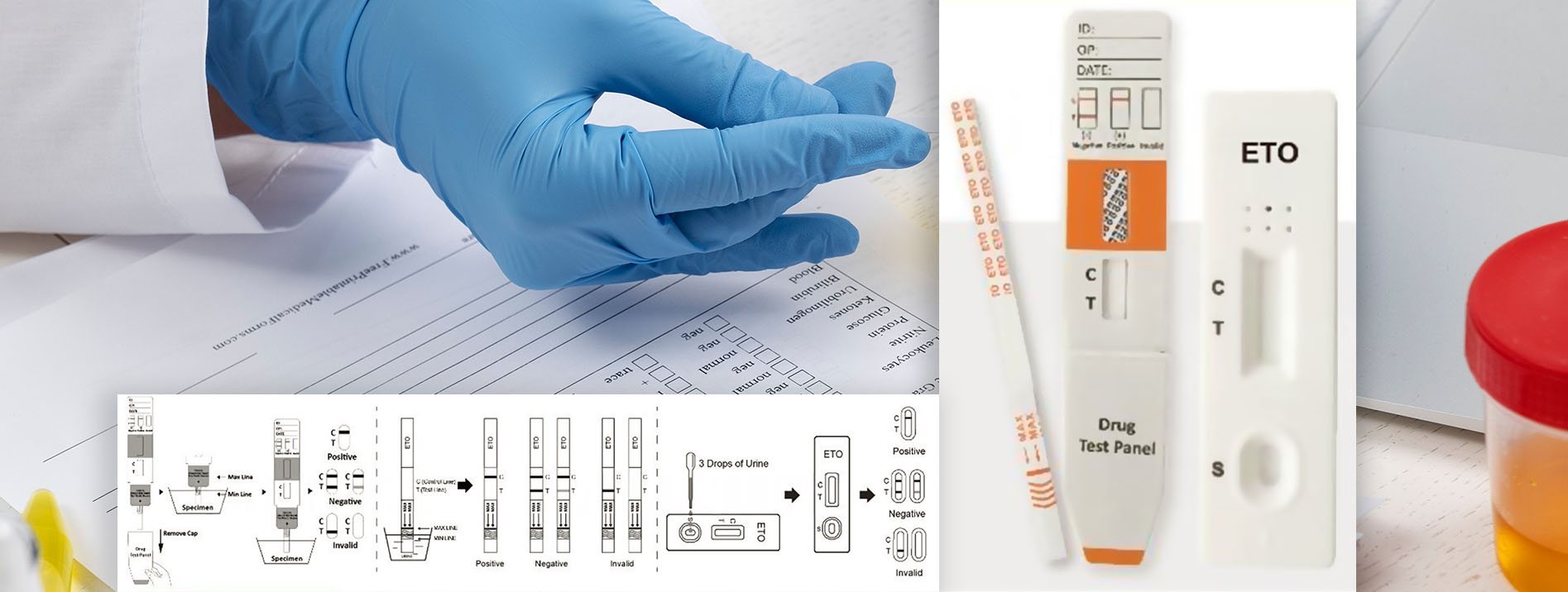 Etomidate (ETO) Rapid Urine Test kit image